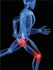 Image partie du corps douloureuse