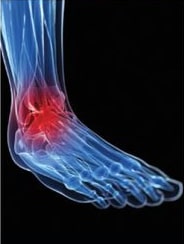 Image partie du corps douloureuse