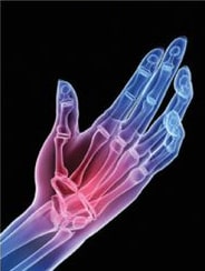 Image partie du corps douloureuse